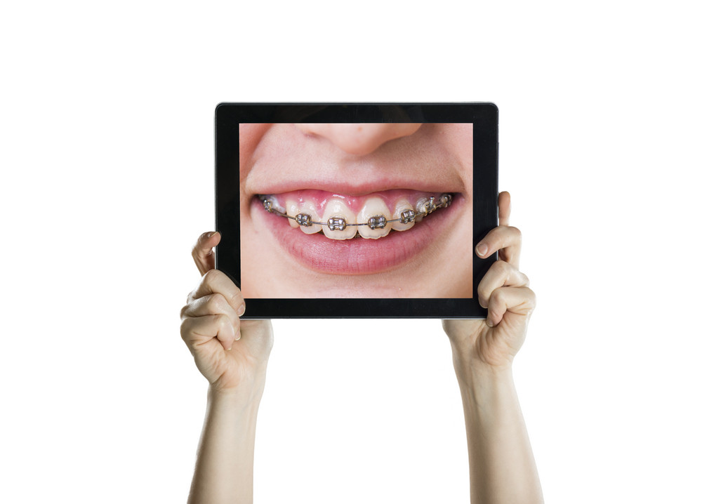 Dental closeup with tablet screen, isolated on white