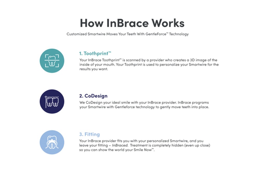 How InBrace Works