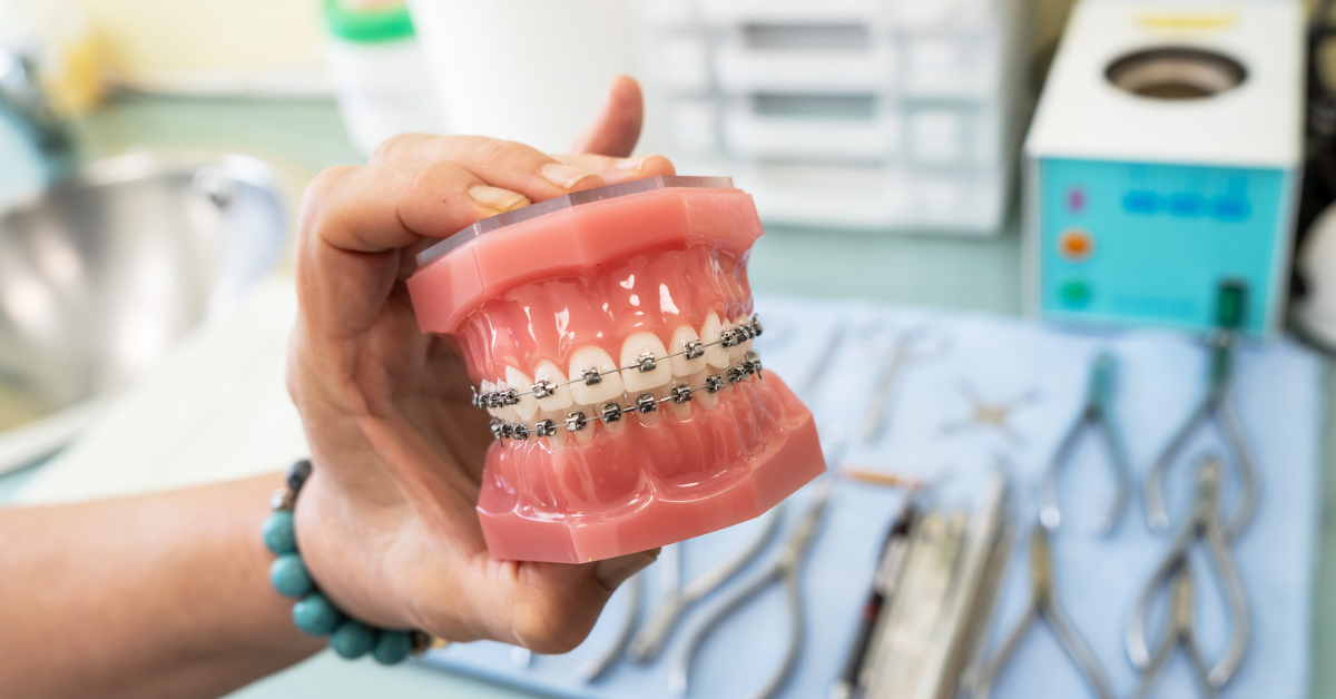 Crossbite Causes, Symptoms, and Treatment Options in Long Beach