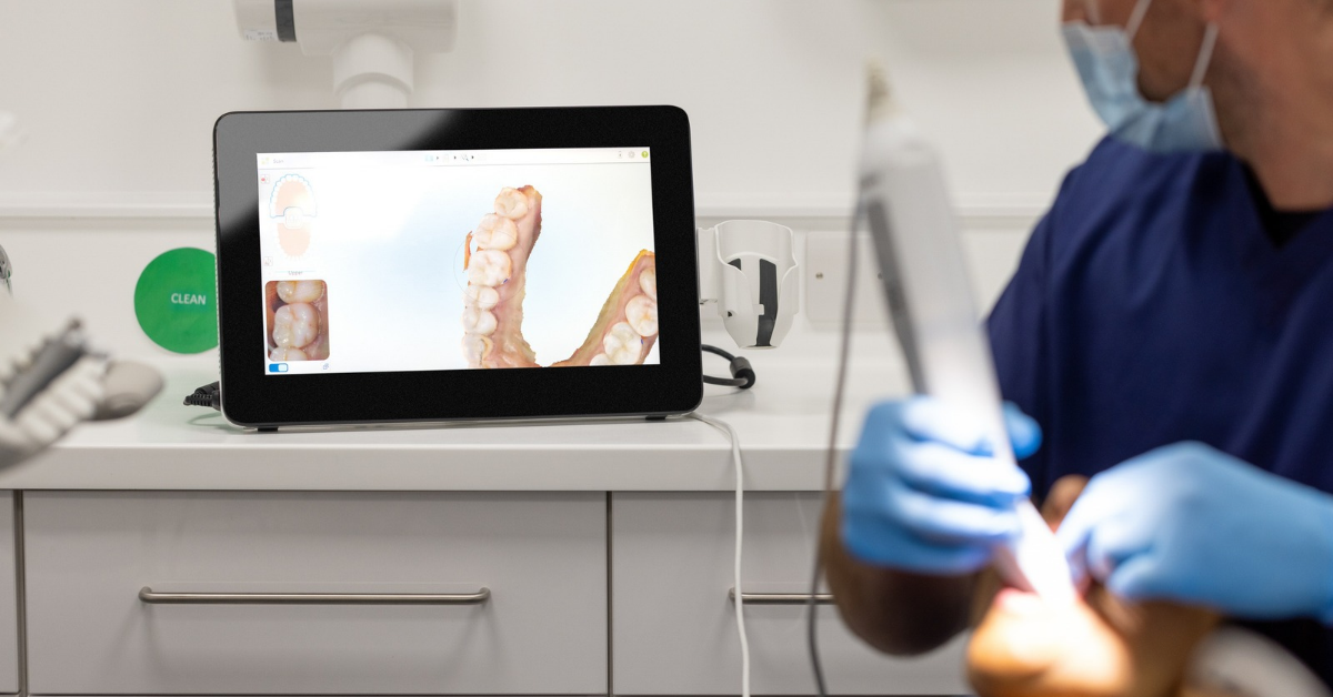 iTero Dental Scans | TruSmile Orthodontics California